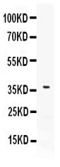 Polyclonal Rabbit anti-Human PD-L2 / PDCD1LG2 / CD273 Antibody (WB)