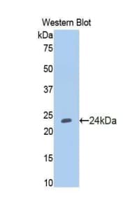 NOS1 / nNOS Antibody (aa53-247)