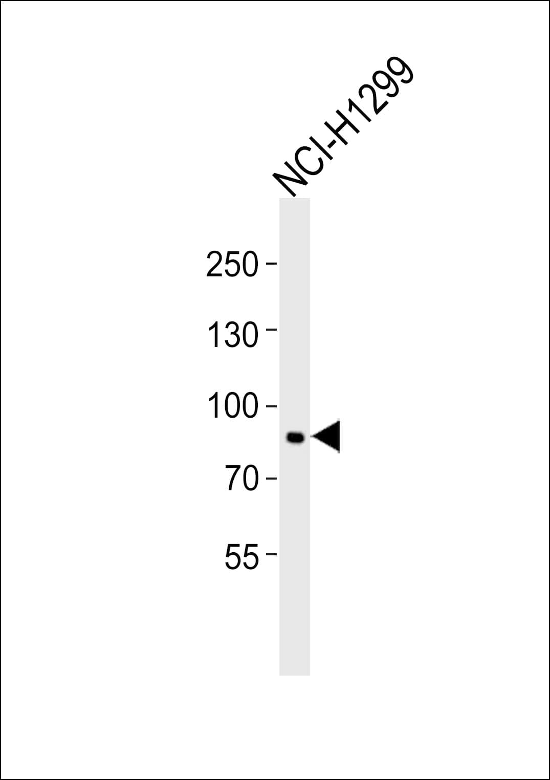 MMP9 / Gelatinase B Antibody (aa644-673)