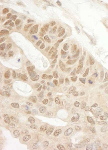 TIPRL / TIP Antibody (aa225-C-term)