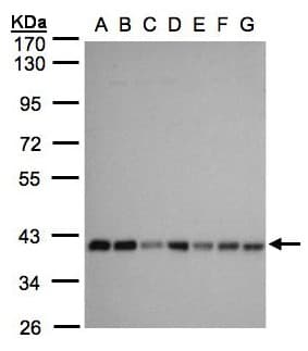 Polyclonal Rabbit anti-Human SLC25A33 Antibody (aa114-321, IHC, WB)