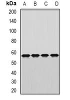 Polyclonal Rabbit anti-Human DARS Antibody (IHC, WB)