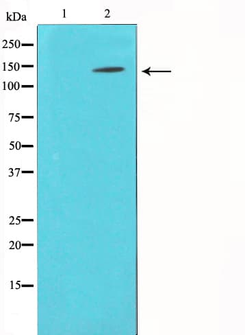 Polyclonal Rabbit anti-Human BCAR1 / p130Cas Antibody (IHC, IF, WB)