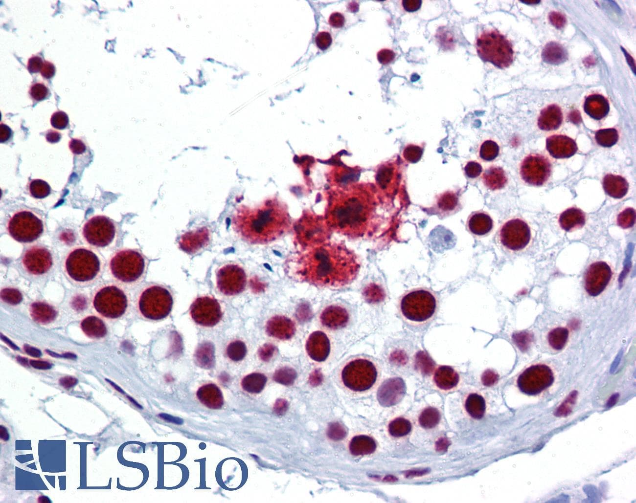 IHC-plus™ SRSF3 / SRP20 Antibody (aa111-160)