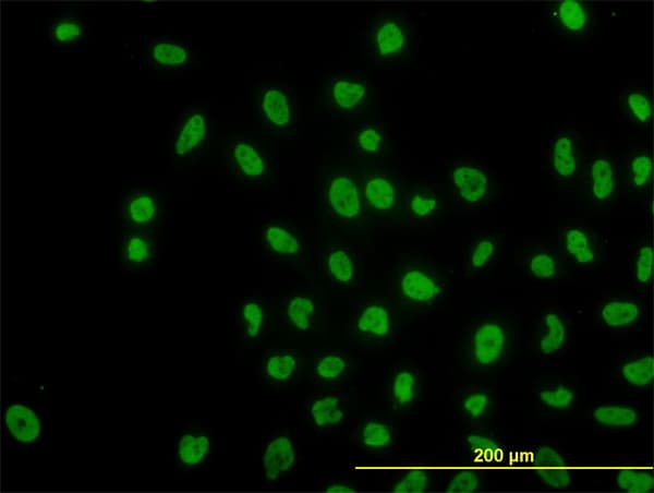 IHC-plus™ ARID1B / BAF250B Antibody (clone 2D2)