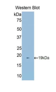 VEGFA / VEGF Antibody (aa27-147)