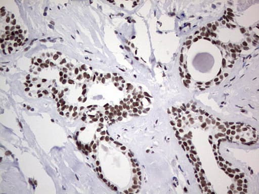 Monoclonal Mouse anti-Human HDAC9 Antibody (clone OTI7G2, aa181-460, IHC, WB)