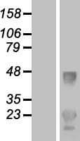 LDLRAD1 Protein (Over-Expression Lysate Myc-DDK (Flag))