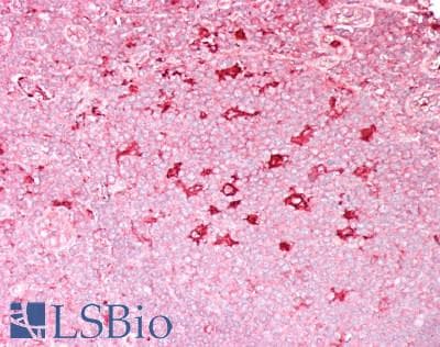IHC-plus™ DEFA1 / Defensin Alpha 1 Antibody (aa1-94)