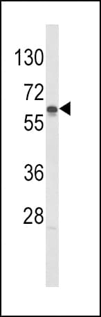 GCK / Glucokinase Antibody (aa403-433)