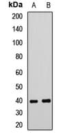 TARBP2 / TRBP2 Antibody
