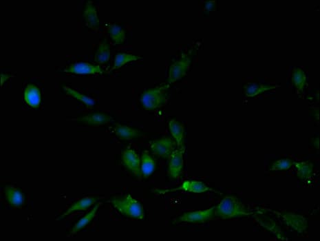 Polyclonal Rabbit anti-Human PIGP Antibody (IHC, IF)
