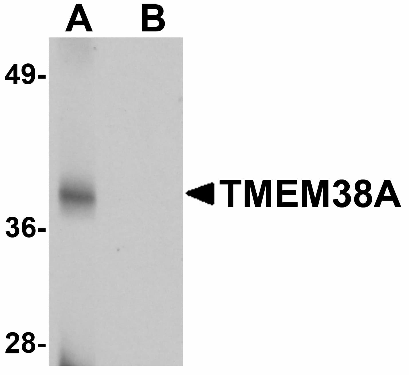 IHC-plus™ TMEM38A Antibody