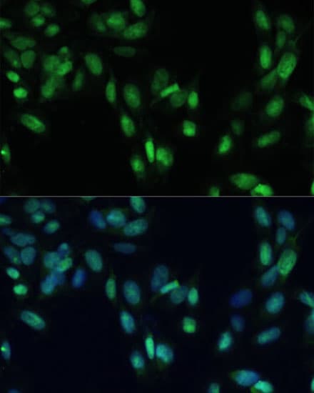 Polyclonal Rabbit anti-Human SMAD7 Antibody (IF, WB)