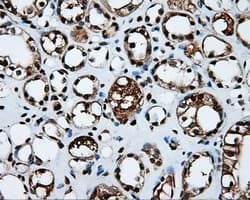Monoclonal Mouse anti-Human APP / Beta Amyloid Precursor Antibody (clone OTI9E2, IHC, IF, WB)