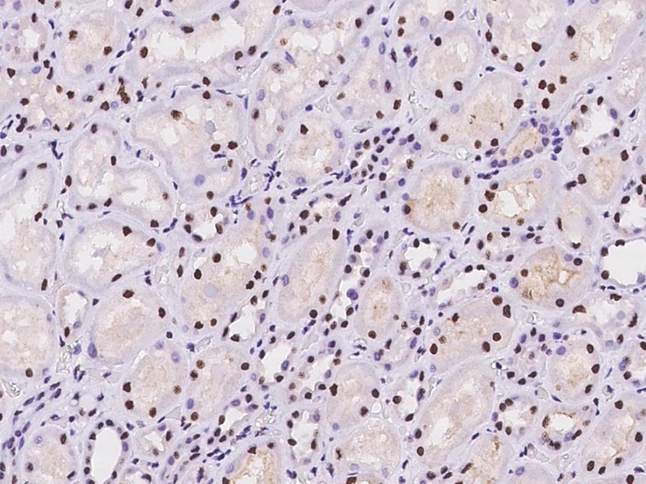 SAFB2 Antibody