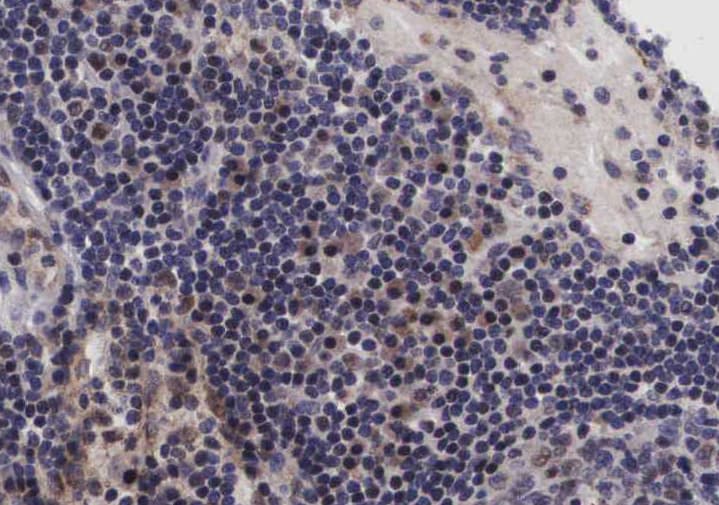 NFKB1 / NF-Kappa-B Antibody (phospho-Ser907)