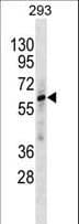 Polyclonal Rabbit anti-Human ZNF775 Antibody (aa406-432, WB)