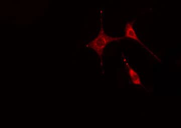 CALD1 / Caldesmon Antibody