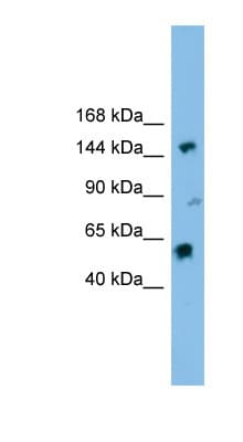 DHX8 Antibody (aa71-120)
