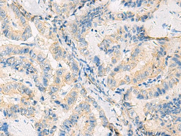 Polyclonal Rabbit anti-Human SYNGR1 / Synaptogyrin 1 Antibody (IHC)