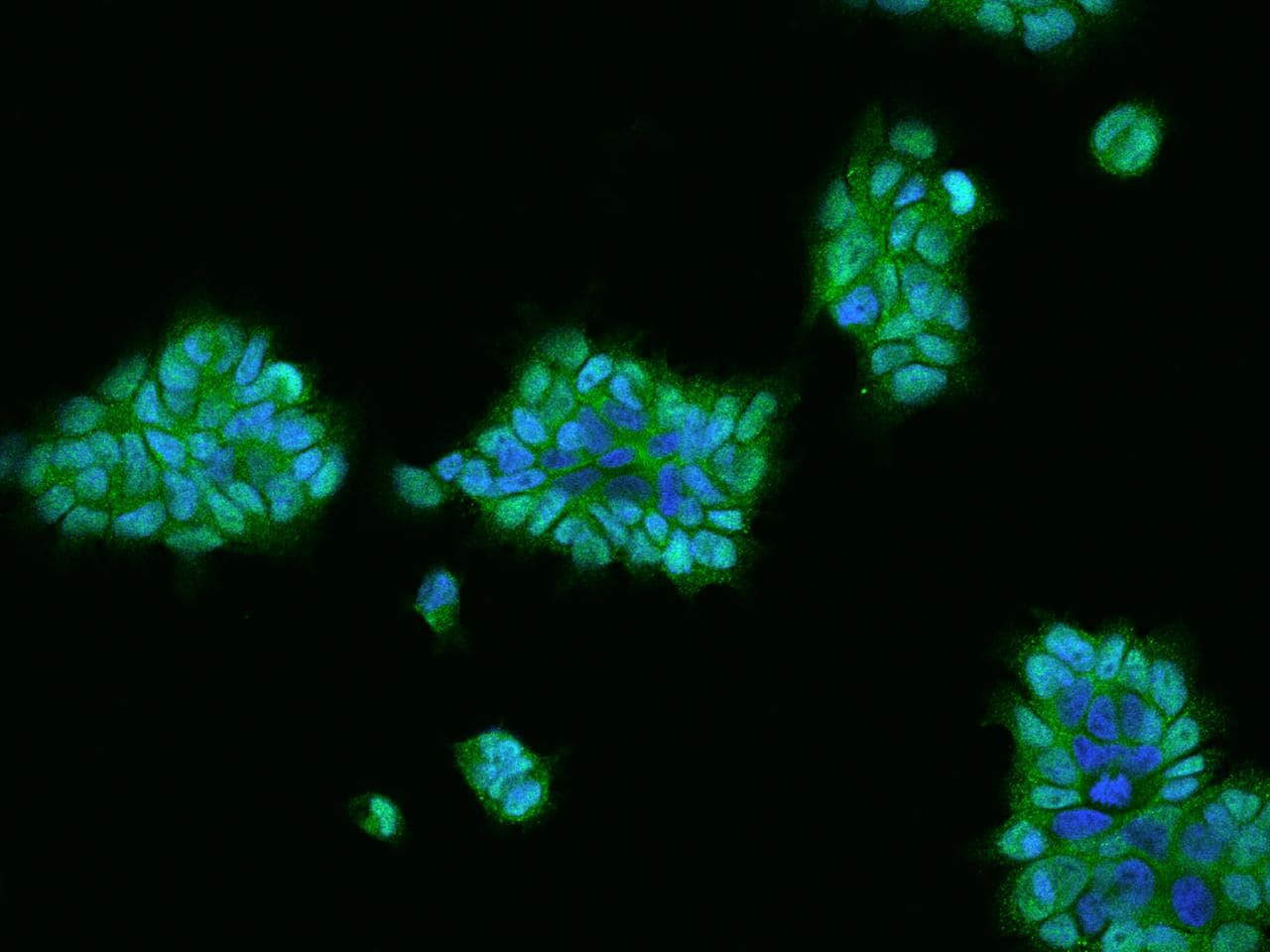 PRKCB / PKC-Beta Antibody