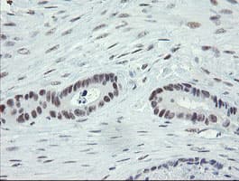ZBED1 / TRAMP Antibody (clone OTI5A2)