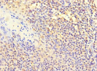 Polyclonal Rabbit anti-Human POLB / DNA Polymerase Beta Antibody