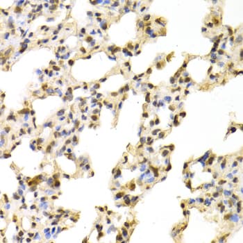 NR1I3 / CAR Antibody