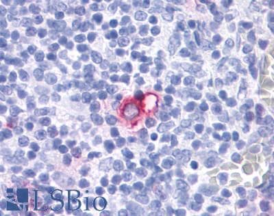 PathPlus™ CCR4 Antibody (C-Terminus)