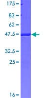 Human HYKK / AGPHD1 Protein (Recombinant GST)