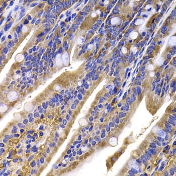 Polyclonal Rabbit anti-Human HDGFRP2 Antibody (IHC, IF, WB)