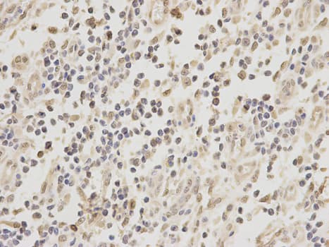 Polyclonal Rabbit anti-Human ZEB1 / AREB6 Antibody (IHC, IF, WB)