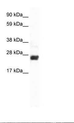 CDX2 Antibody (aa161-210)