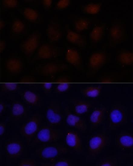 ACADSB Antibody