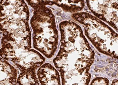 ERAL1 Antibody