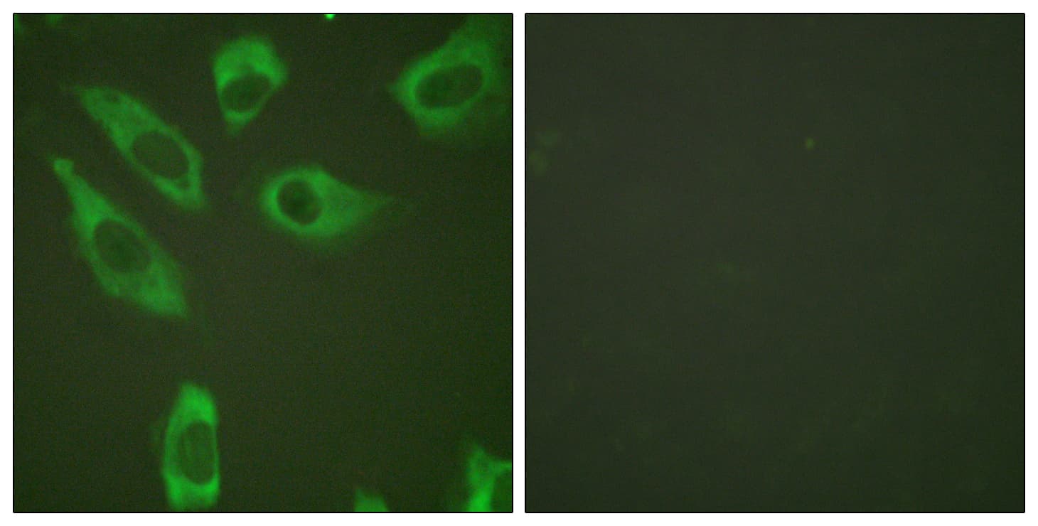 RPS6 / Ribosomal Protein S6 Antibody (phospho-Ser240)