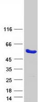 Human DDI2 Protein (Recombinant Myc-DDK (Flag))