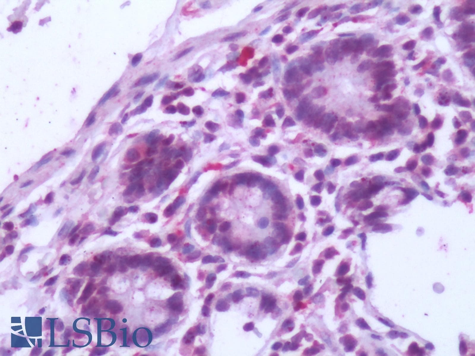 PathPlus™ NR5A2 / LRH-1 Antibody (Internal)