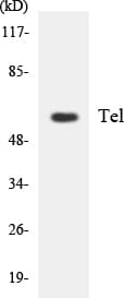 IHC-plus™ Polyclonal Rabbit anti-Human ETV6 / TEL Antibody (aa202-251, IHC, WB)