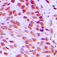 FOS / c-FOS Antibody (N-Terminus)