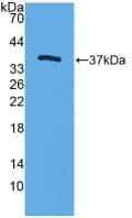TFF3 / Trefoil Factor 3 Antibody (aa23-81)