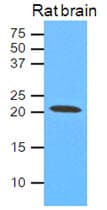 CAV1 / Caveolin 1 Antibody (clone AT4C1)