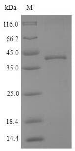 Dog CTSK / Cathepsin K Protein (Recombinant 6His-SUMO, N-terminus)