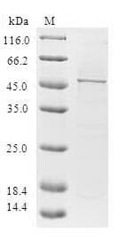 Human DHAND / HAND2 Protein (Recombinant GST, N-terminus)