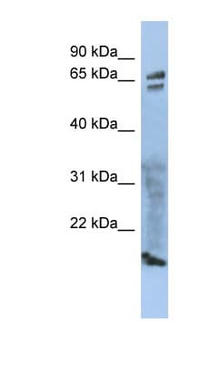 ZP1 Antibody (aa215-264)