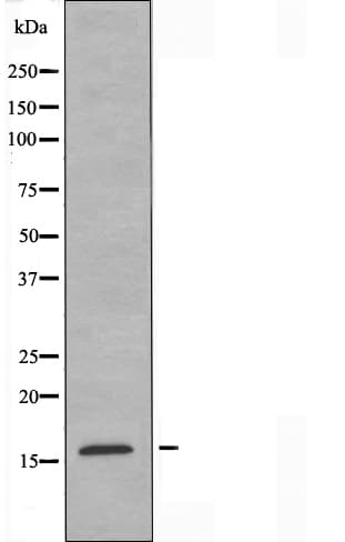 CRABP2 Antibody