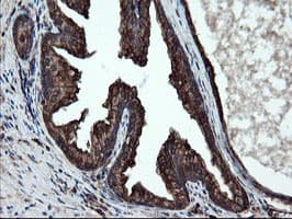 SKIL / SNO / SnoN Antibody (clone OTI3E9)