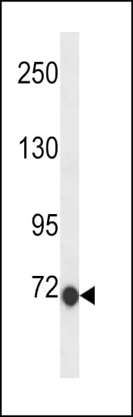 CLIC6 Antibody (aa676-704)