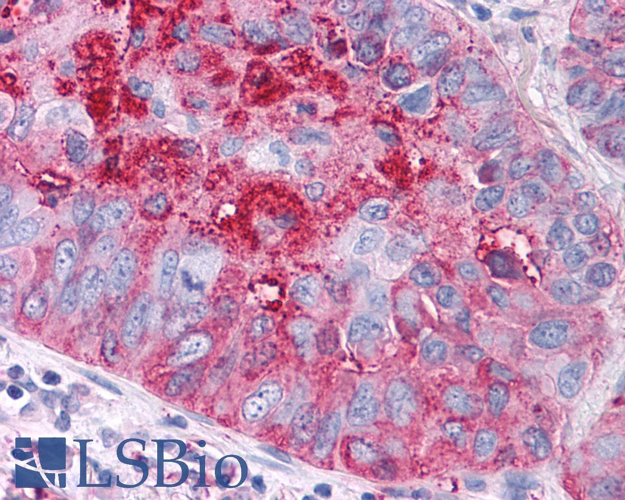 PathPlus™ FZD1 / Frizzled 1 Antibody (N-Terminus)